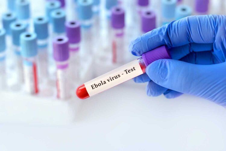 Un médico sostiene un tubo de muestra de sangre para un test de ébola